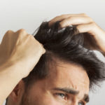 Frenar la caída del cabello por estrés. Medicina Estética Maestro. Medicina capilar en Oviedo