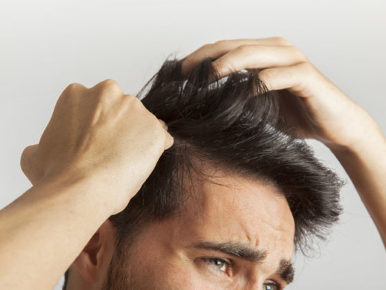 Frenar la caída del cabello por estrés. Medicina Estética Maestro. Medicina capilar en Oviedo