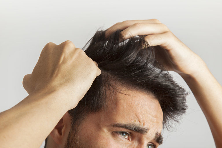 Frenar la caída del cabello por estrés. Medicina Estética Maestro. Medicina capilar en Oviedo