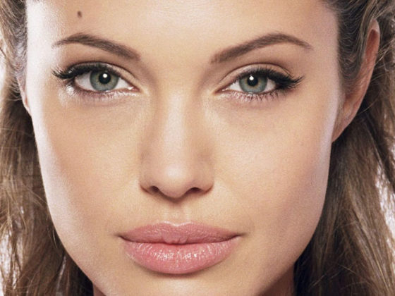 Cejas caídas