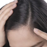 Consejos para el cuidado del cuero cabelludo