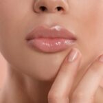 Mujer labios con ácido hialurónico, El retinol y el acido hialurónico -Ácido Hialurónico Oviedo